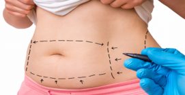 7 Amazing Benefits of Tummy Tuck Surgery You Could Be Missing Out