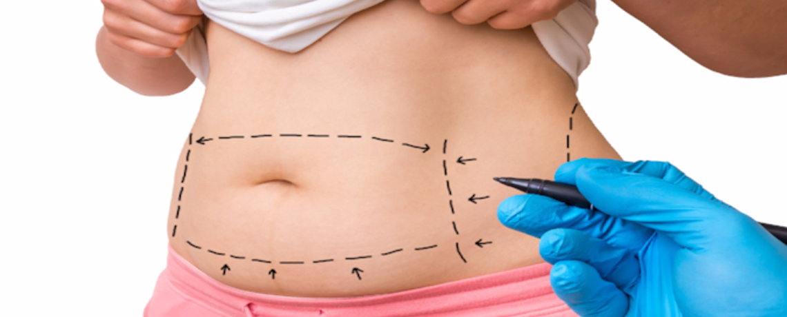 7 Amazing Benefits of Tummy Tuck Surgery You Could Be Missing Out
