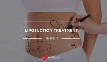 Liposuction Treatment Cost in India | Best Hospitals for Liposuction Treatment in India