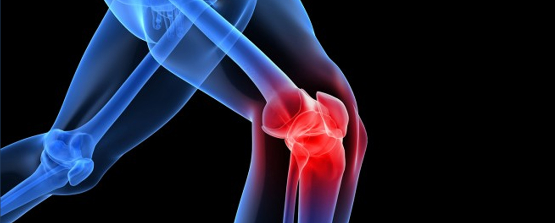 This Treatment Can Help Patients With Arthritis. Not Total Knee Replacement