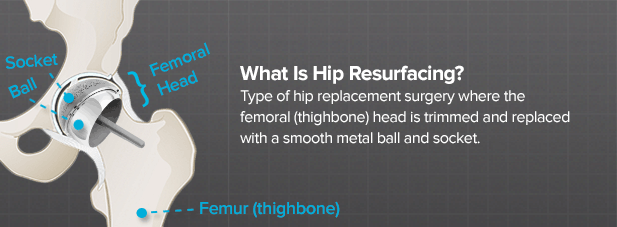 what is hip resurfacing surgery