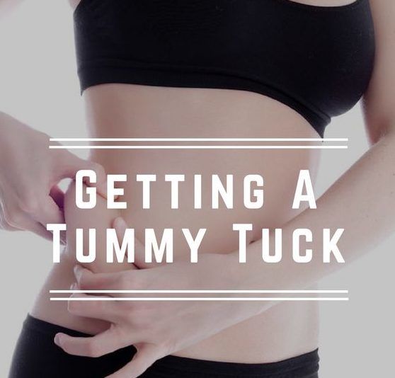 tummy tuck vs weight loss surgery