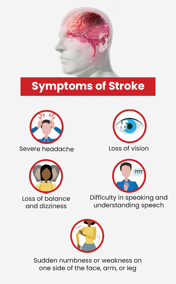 Symptoms of Stroke - Infographics