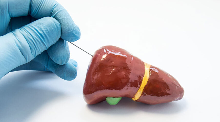 Diagnosis of Liver Disease - Biopsy
