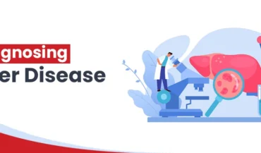 ما هو تشخيص أمراض الكبد