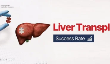Success Rate of Liver Transplant