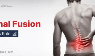The Success Rate of Spinal Fusion
