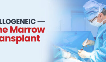 Allogeneic Bone Marrow Transplantation, Types, Procedure & Risks