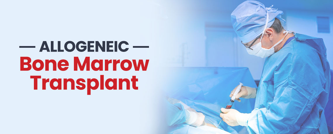 Allogeneic Bone Marrow Transplantation, Types, Procedure & Risks