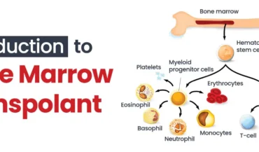 All You Need to Know About Bone Marrow Transplant