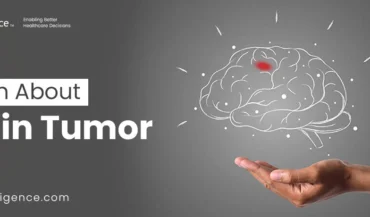 Learn About Brain Tumor: Types, Myths and Risk Factors