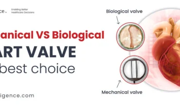 Valve mécanique VS biologique | La meilleure valve cardiaque pour vous
