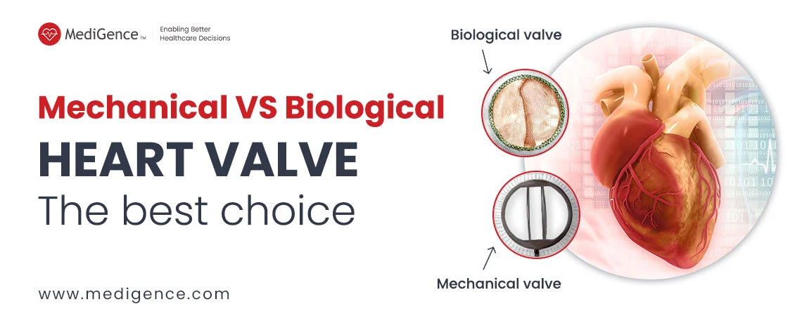 Mechanical VS Biological Valve | The Best Heart Valve for You