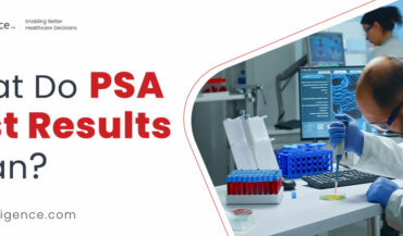 نتائج اختبار مستضد البروستات النوعي (PSA) - ماذا تعني؟