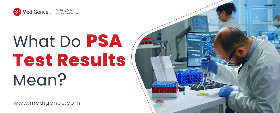 Prostate Specific Antigen (PSA) Test Results – What Do They Mean?