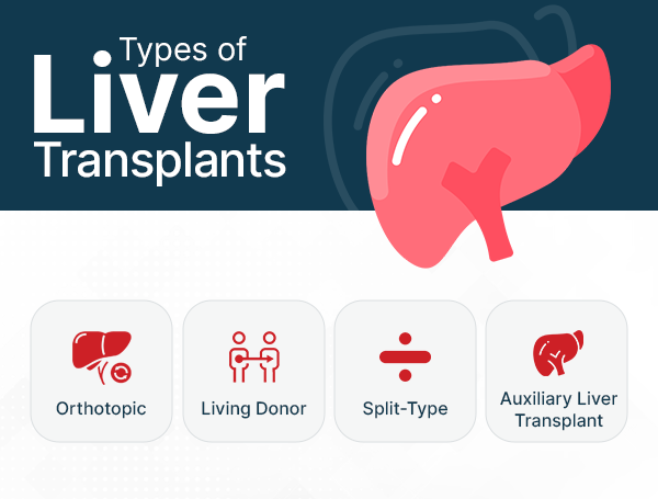 Types of Liver Transplantation in India and Their Cost