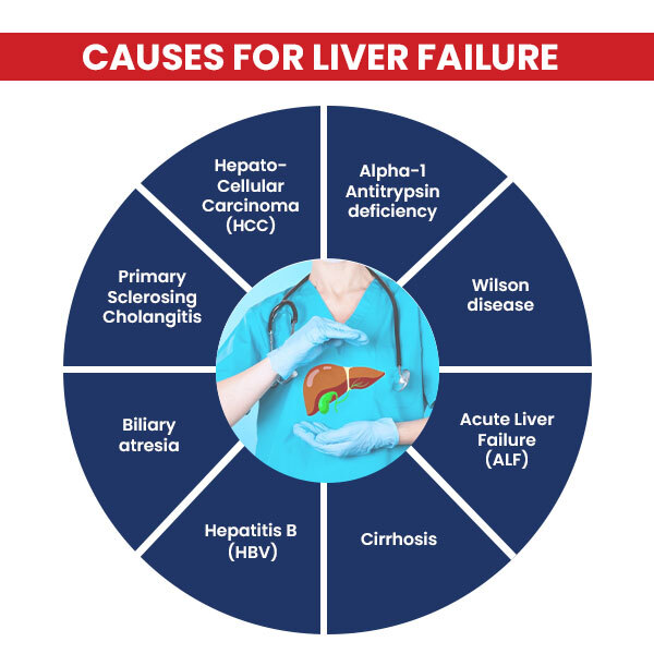 Causes for Liver Failure