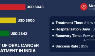 Oral Cancer Treatment Cost in India