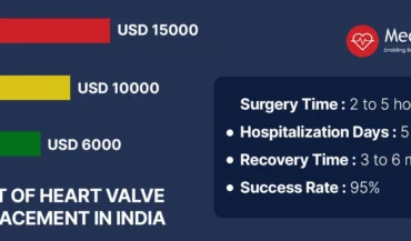 Cost Guide of Heart Valve Replacement in India