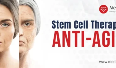 العلاج بالخلايا الجذعية لمكافحة الشيخوخة