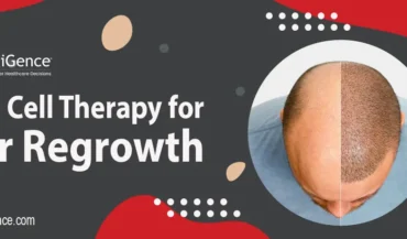 العلاج بالخلايا الجذعية لإعادة نمو الشعر