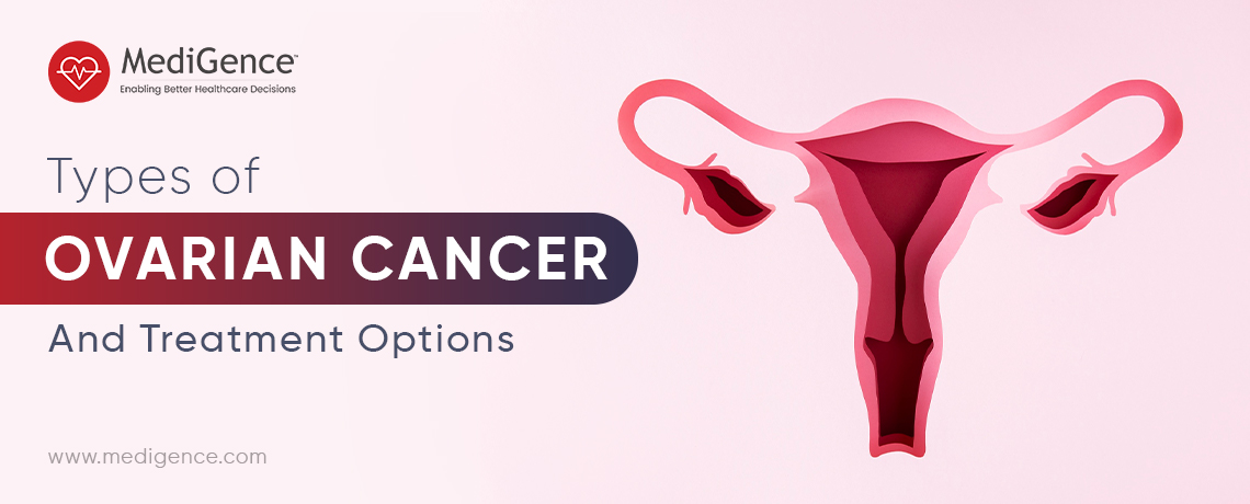 أنواع سرطان المبيض وخيارات العلاج